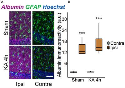 Initiation of Experimental Temporal Lobe Epilepsy by Early Astrocyte Uncoupling Is Independent of TGFβR1/ALK5 Signaling